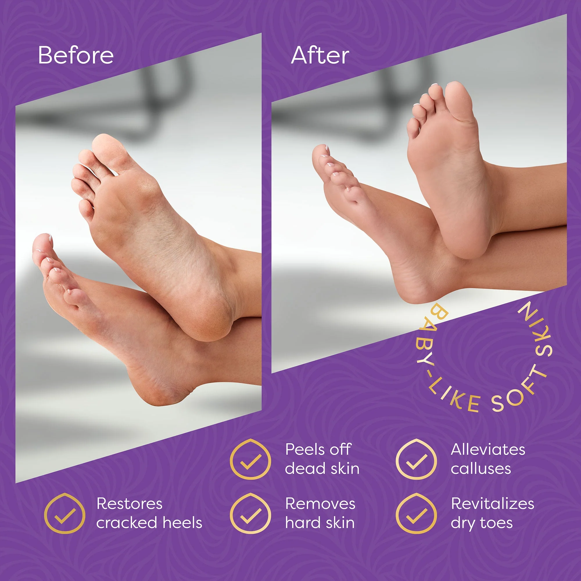 Aesta 3-in-1 Foot Peel Mask, Full-Cycle Foot Care: Revitalizing Mousse + Feet Peeling Mask + Moisturizing Cream | All-Natural Foot Peel Mask for Dry Cracked Feet | Baby Feet Foot Peel Treatment Set - Image 5