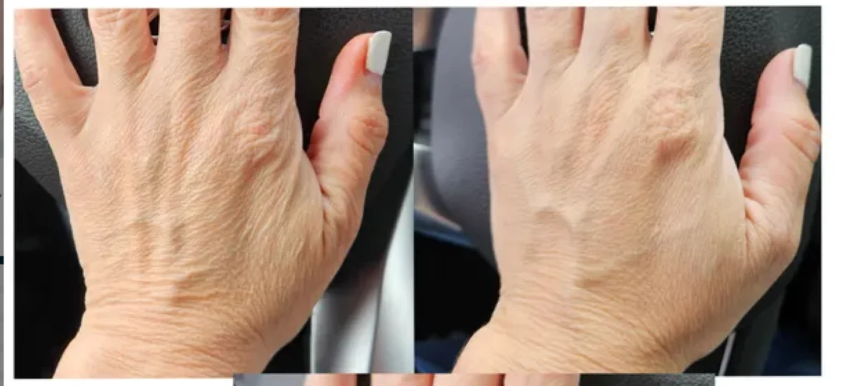 Numiere Hand Glow – LED Light Therapy for Hand & Wrist Rejuvenation - Image 8